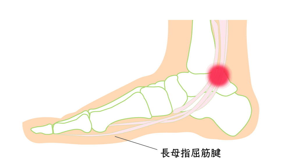 足首 関節 鳴る