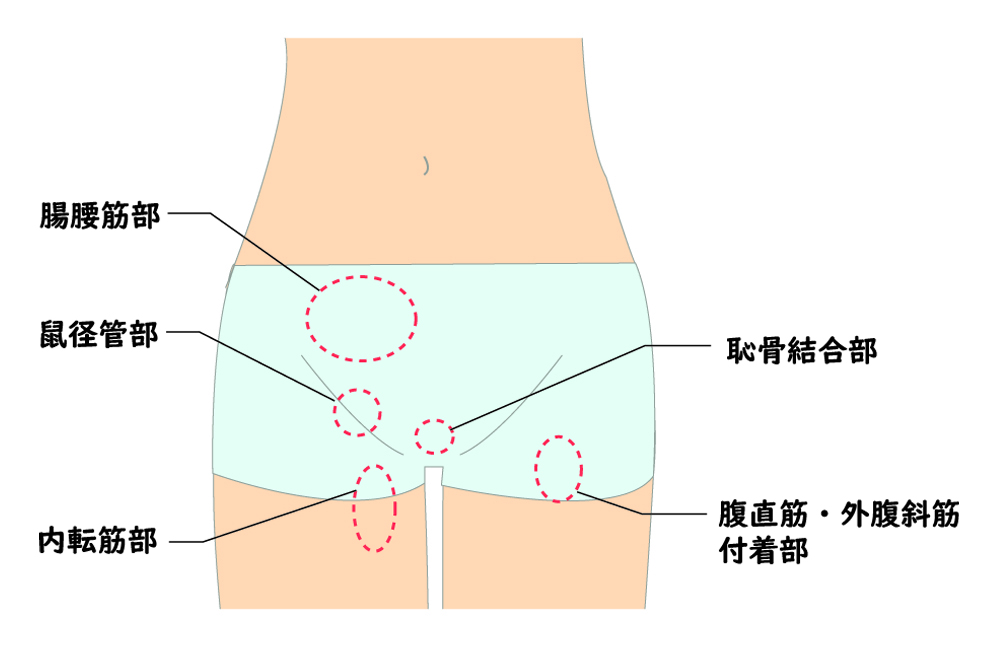 鼠蹊 部 が 痛い